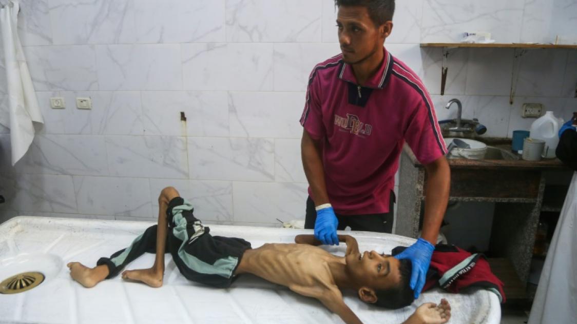 Un H pital De Gaza Dit Que 21 Enfants Sont Morts De Malnutrition Ou De Faim un-h-pital-de-gaza-dit-que-21-enfants-sont-morts-de-malnutrition-ou-de-faim