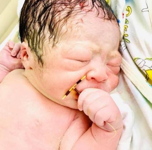 Photo Virale Un Bebe Nait Avec Le Sterilet De Sa Mere Dans La Main Photo Virale Un Bebe Nait Avec Le Sterilet De Sa Mere Dans La Main