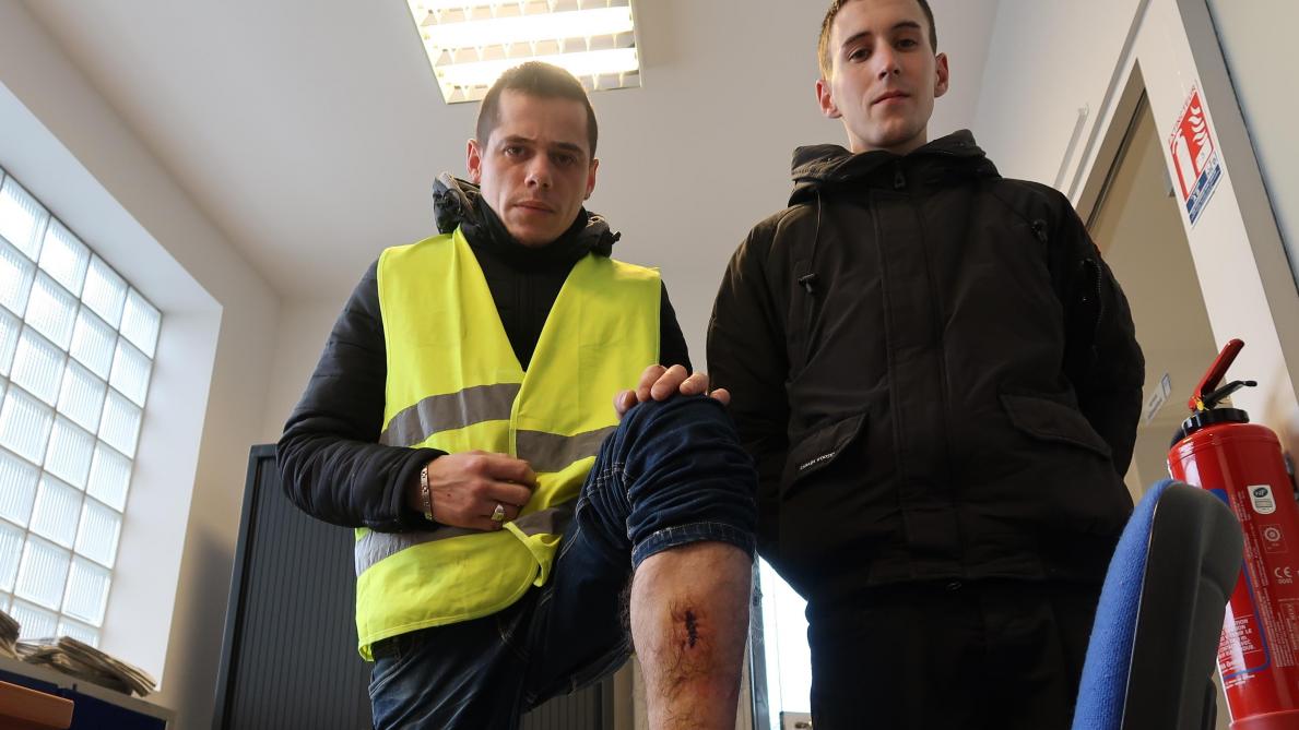 Un Gilet Jaune Sparnacien Blessé Lors De La Manifestation Du