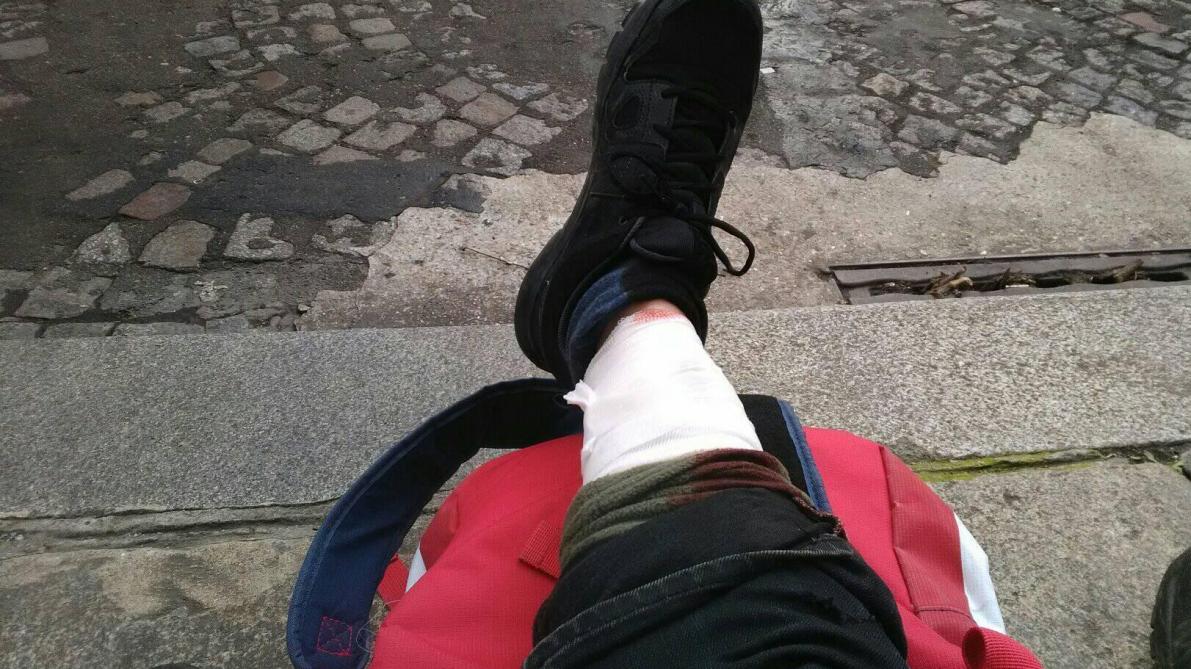 Gilets Jaunes Un élu Régional Rn De Laube Blessé Par Un