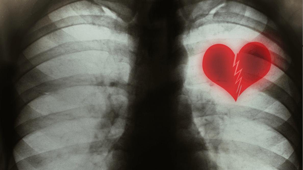Et S Il Existait Desormais Un Traitement Contre Les Chagrins D Amour Et S Il Existait Desormais Un Traitement Contre Les Chagrins D Amour