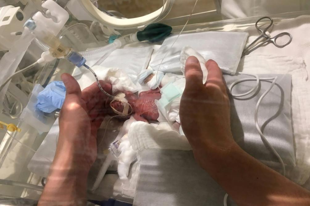 Japon Ne A 268 Grammes Un Bebe Quitte L Hopital En Bonne Sante Japon Ne A 268 Grammes Un Bebe Quitte L Hopital En Bonne Sante