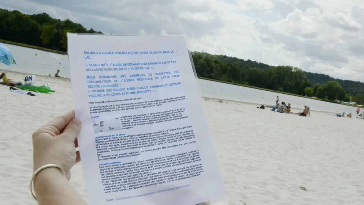 Des Eruptions Cutanees Suspectes Apres Une Baignade A Axo Plage