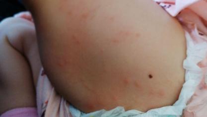 La Nouvelle Guerre Des Boutons A Soissons