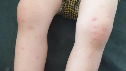 La Nouvelle Guerre Des Boutons A Soissons